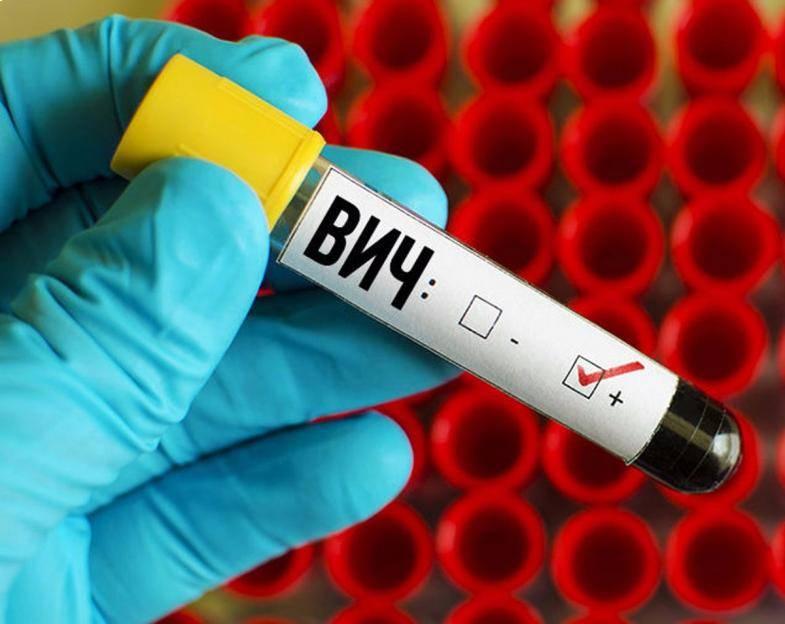 40 случаев ВИЧ-инфекции выявлено за три месяца в Могилевской области