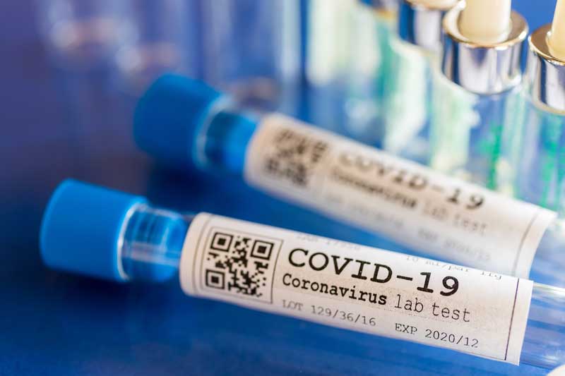 В октябре от COVID-19 в мире умер каждый 60-й заразившийся