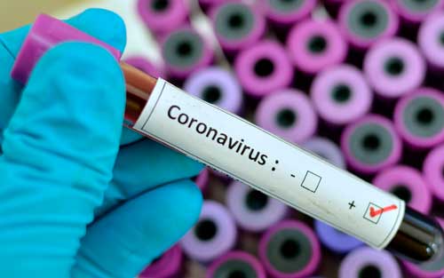 Вирусолог назвал признаки полного выздоровления от COVID-19