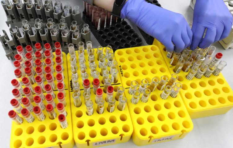 В России создали первый в мире экспресс-тест на гепатит С