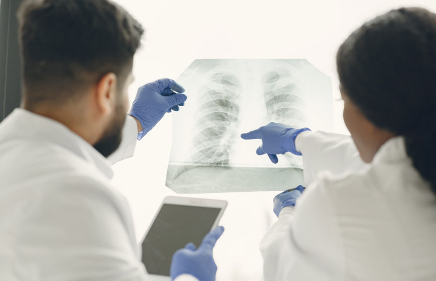 Медики назвали неожиданную причину рака легких