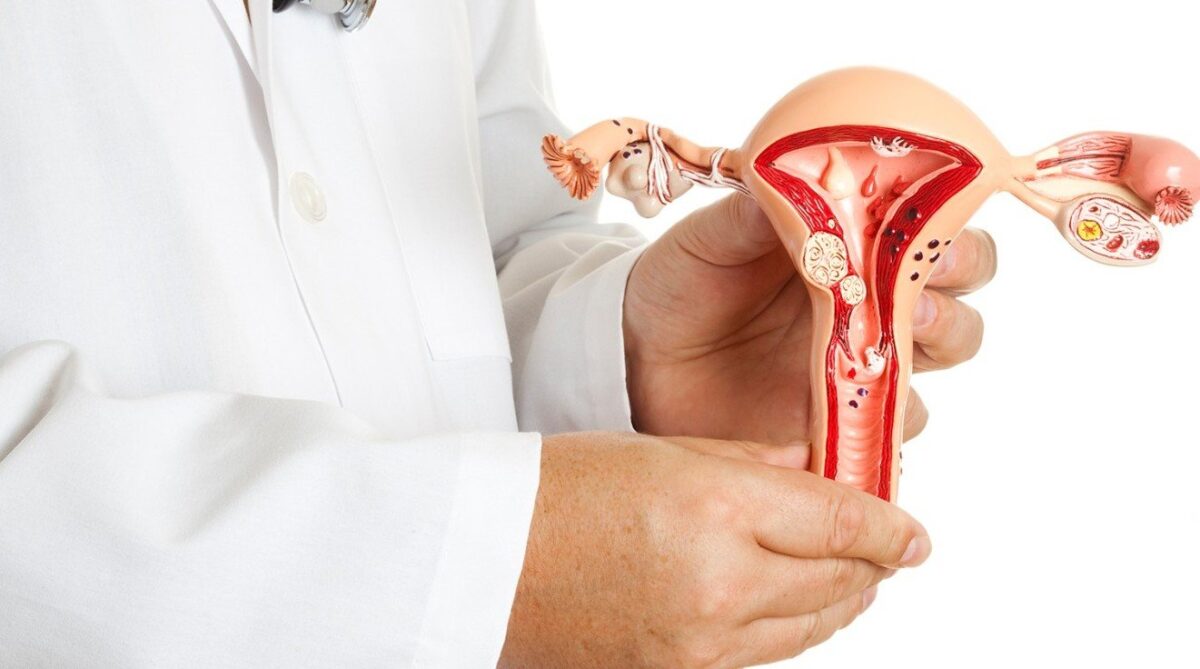 Когда миома действительно опасна, а в каких случаях достаточно простого наблюдения, рассказал гинеколог